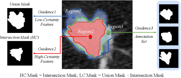 Figure 3 for Lung Nodule Segmentation and Low-Confidence Region Prediction with Uncertainty-Aware Attention Mechanism