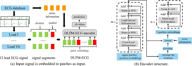 Figure 1 for A Dual-scale Lead-seperated Transformer With Lead-orthogonal Attention And Meta-information For Ecg Classification