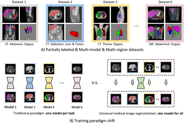 Figure 1 for Training Like a Medical Resident: Universal Medical Image Segmentation via Context Prior Learning