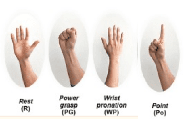 Figure 4 for Ultrasound Based Prosthetic Arm Control