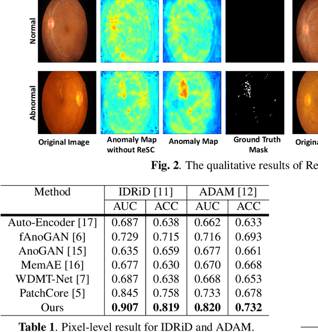 Figure 2 for Region and Spatial Aware Anomaly Detection for Fundus Images