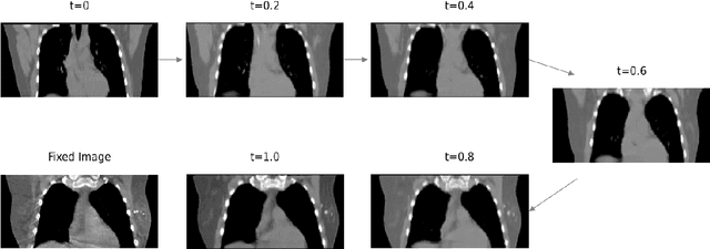 Figure 4 for INR-LDDMM: Fluid-based Medical Image Registration Integrating Implicit Neural Representation and Large Deformation Diffeomorphic Metric Mapping