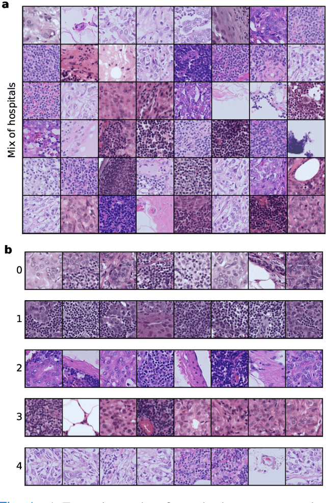 Figure 4 for Deep Hypothesis Tests Detect Clinically Relevant Subgroup Shifts in Medical Images