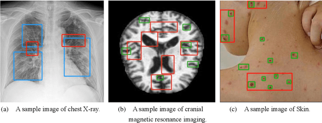 Figure 1 for EAFP-Med: An Efficient Adaptive Feature Processing Module Based on Prompts for Medical Image Detection