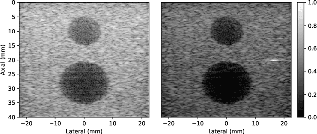 Figure 1 for Robust RF Data Normalization for Deep Learning