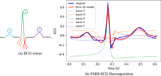 Figure 1 for FMM-Head: Enhancing Autoencoder-based ECG anomaly detection with prior knowledge
