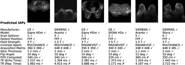 Figure 3 for Reverse Engineering Breast MRIs: Predicting Acquisition Parameters Directly from Images