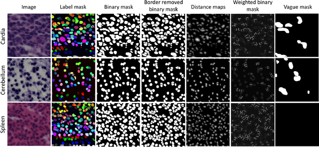 Figure 2 for NuInsSeg: A Fully Annotated Dataset for Nuclei Instance Segmentation in H&E-Stained Histological Images