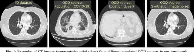 Figure 1 for Limitations of Out-of-Distribution Detection in 3D Medical Image Segmentation