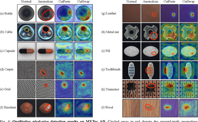 Figure 4 for Multilevel Saliency-Guided Self-Supervised Learning for Image Anomaly Detection