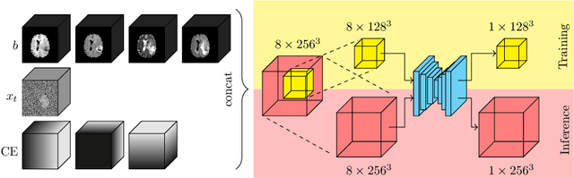 Figure 1 for Diffusion Models for Memory-efficient Processing of 3D Medical Images