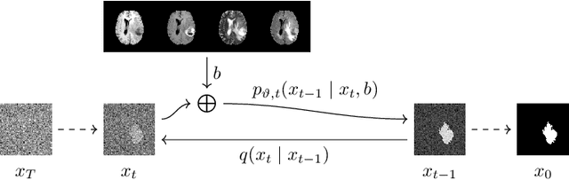 Figure 4 for Diffusion Models for Memory-efficient Processing of 3D Medical Images