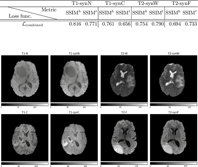 Figure 4 for BraSyn 2023 challenge: Missing MRI synthesis and the effect of different learning objectives