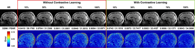 Figure 3 for Unpaired MRI Super Resolution with Self-Supervised Contrastive Learning