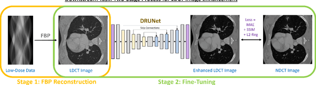 Figure 1 for Low-Dose CT Image Reconstruction by Fine-Tuning a UNet Pretrained for Gaussian Denoising for the Downstream Task of Image Enhancement