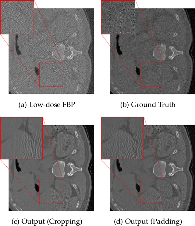 Figure 3 for Low-Dose CT Image Reconstruction by Fine-Tuning a UNet Pretrained for Gaussian Denoising for the Downstream Task of Image Enhancement