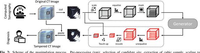 Figure 3 for M3Dsynth: A dataset of medical 3D images with AI-generated local manipulations