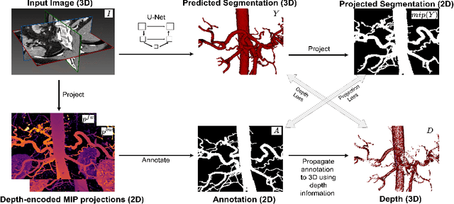 Figure 1 for 3D Arterial Segmentation via Single 2D Projections and Depth Supervision in Contrast-Enhanced CT Images