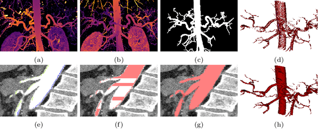 Figure 3 for 3D Arterial Segmentation via Single 2D Projections and Depth Supervision in Contrast-Enhanced CT Images