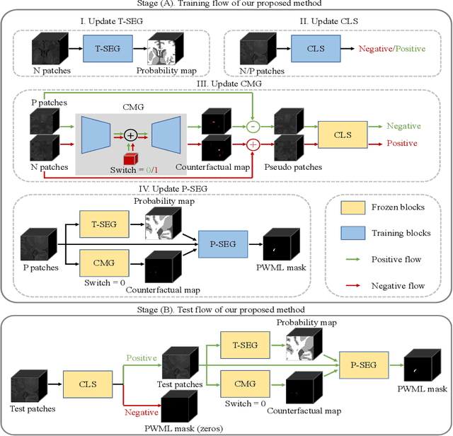 Figure 1 for Punctate White Matter Lesion Segmentation in Preterm Infants Powered by Counterfactually Generative Learning