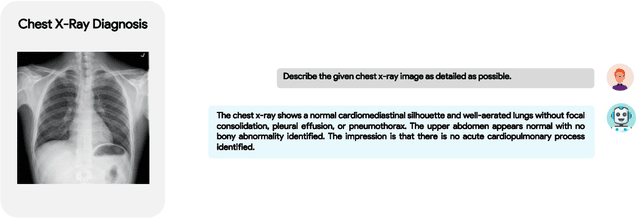 Figure 3 for XrayGPT: Chest Radiographs Summarization using Medical Vision-Language Models