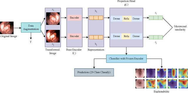 Figure 1 for Gastrointestinal Disease Classification through Explainable and Cost-Sensitive Deep Neural Networks with Supervised Contrastive Learning