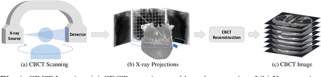 Figure 1 for Geometry-Aware Attenuation Field Learning for Sparse-View CBCT Reconstruction