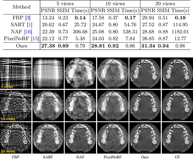 Figure 2 for Geometry-Aware Attenuation Field Learning for Sparse-View CBCT Reconstruction