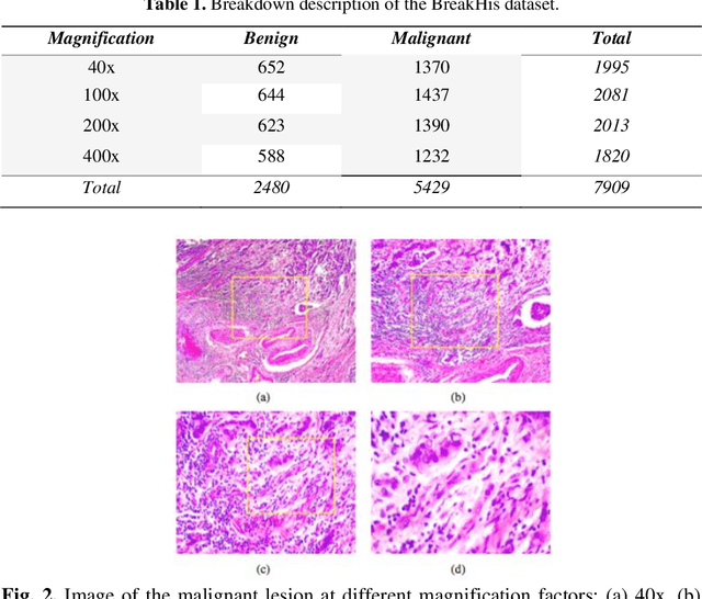 Figure 2 for Breast Cancer Detection and Diagnosis: A comparative study of state-of-the-arts deep learning architectures