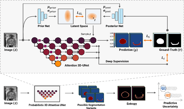 Figure 1 for Uncertainty-Aware Semi-Supervised Learning for Prostate MRI Zonal Segmentation