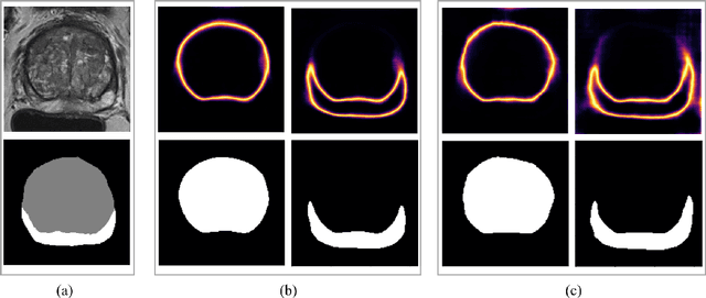 Figure 3 for Uncertainty-Aware Semi-Supervised Learning for Prostate MRI Zonal Segmentation