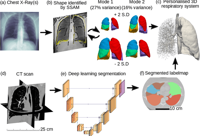 Figure 1 for Validated respiratory drug deposition predictions from 2D and 3D medical images with statistical shape models and convolutional neural networks