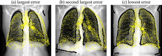 Figure 4 for Validated respiratory drug deposition predictions from 2D and 3D medical images with statistical shape models and convolutional neural networks