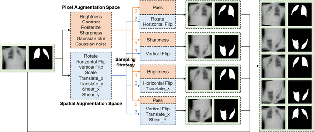 Figure 1 for MedAugment: Universal Automatic Data Augmentation Plug-in for Medical Image Analysis
