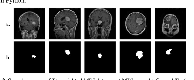 Figure 3 for Brain Tumor Segmentation from MRI Images using Deep Learning Techniques