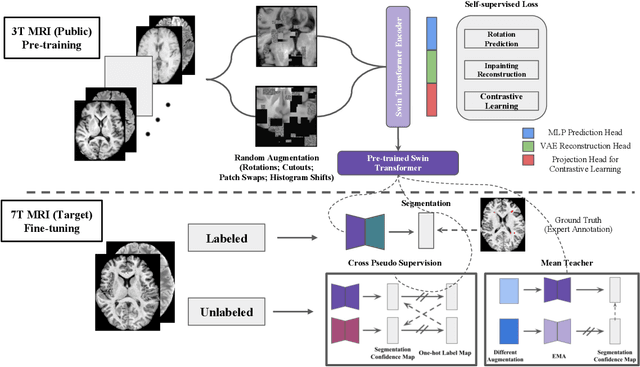 Figure 2 for SSL^2: Self-Supervised Learning meets Semi-Supervised Learning: Multiple Sclerosis Segmentation in 7T-MRI from large-scale 3T-MRI