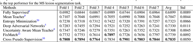 Figure 3 for SSL^2: Self-Supervised Learning meets Semi-Supervised Learning: Multiple Sclerosis Segmentation in 7T-MRI from large-scale 3T-MRI