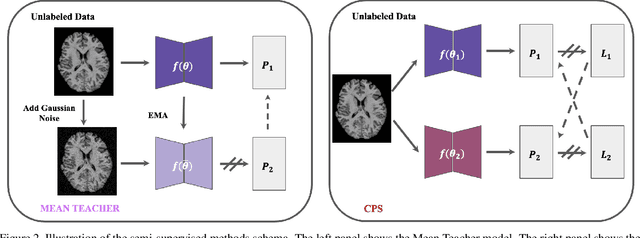 Figure 4 for SSL^2: Self-Supervised Learning meets Semi-Supervised Learning: Multiple Sclerosis Segmentation in 7T-MRI from large-scale 3T-MRI