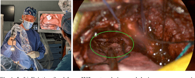 Figure 1 for Deep Reinforcement Learning Based System for Intraoperative Hyperspectral Video Autofocusing