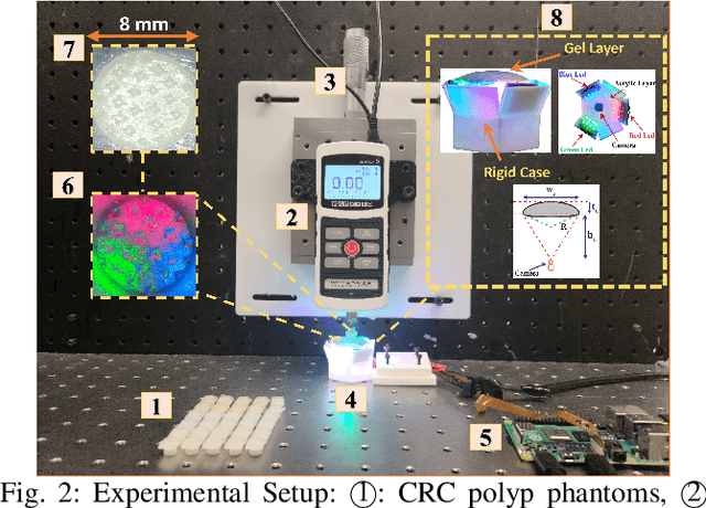 Figure 2 for Towards Reliable Colorectal Cancer Polyps Classification via Vision Based Tactile Sensing and Confidence-Calibrated Neural Networks