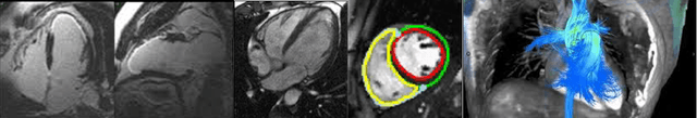 Figure 1 for Multimodal Representation Learning of Cardiovascular Magnetic Resonance Imaging