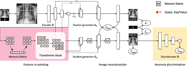 Figure 3 for Exploiting Structural Consistency of Chest Anatomy for Unsupervised Anomaly Detection in Radiography Images