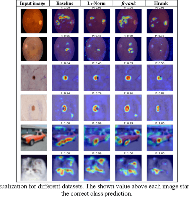 Figure 3 for Beta-Rank: A Robust Convolutional Filter Pruning Method For Imbalanced Medical Image Analysis