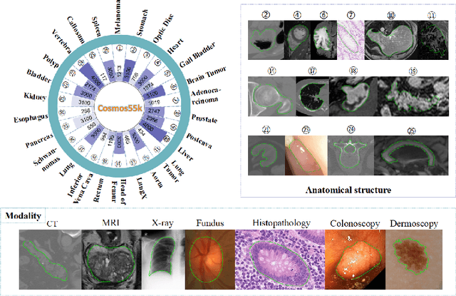 Figure 1 for Instructive Feature Enhancement for Dichotomous Medical Image Segmentation