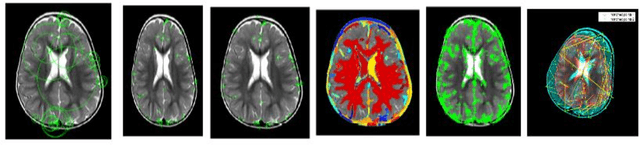 Figure 3 for Evaluating the anticipated outcomes of MRI seizure image from open-source tool- Prototype approach