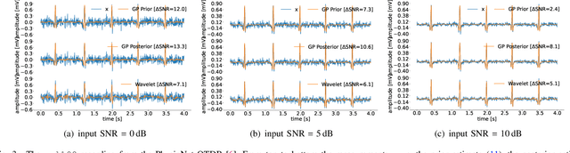 Figure 3 for A Data-Driven Gaussian Process Filter for Electrocardiogram Denoising