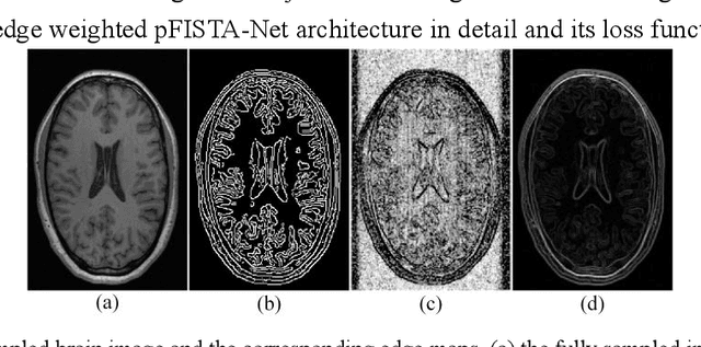 Figure 1 for Edge-weighted pFISTA-Net for MRI Reconstruction