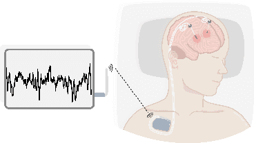 Figure 2 for Automatic Sleep Stage Classification with Cross-modal Self-supervised Features from Deep Brain Signals