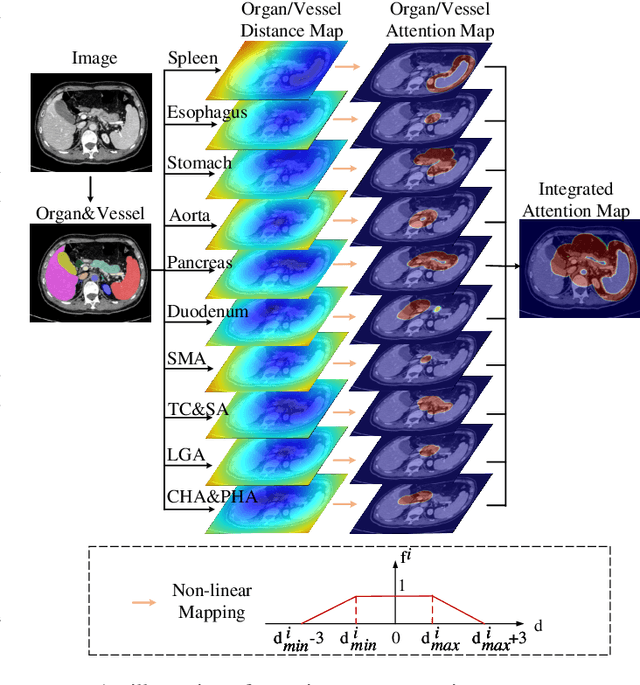 Figure 3 for A deep local attention network for pre-operative lymph node metastasis prediction in pancreatic cancer via multiphase CT imaging