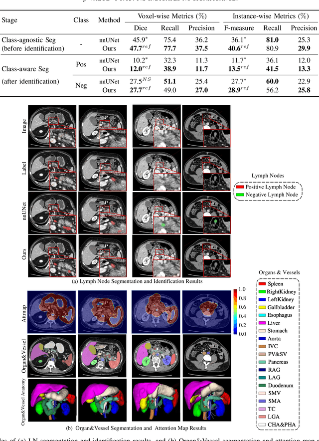 Figure 4 for A deep local attention network for pre-operative lymph node metastasis prediction in pancreatic cancer via multiphase CT imaging